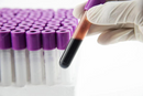 Tubo de Coleta de Sangue EDTA Roxo 100un - Labor Import