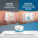 Fita Cirúrgica Microporosa Branca 2,5cm x 10m - Wiltex